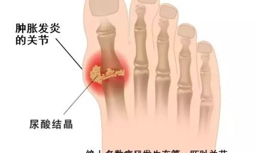 酸雌二醇片是激素药吗-酸雌二醇片说明书网 - 为你提供酸雌性二醇片、酸雌二醇片是避孕药吗